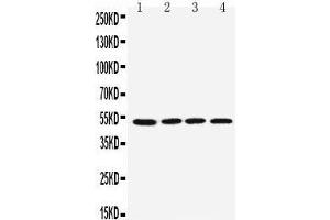 Anti-muscarinic Acetylcholine Receptor 1 antibody, Western blotting Lane 1: Rat Brain Tissue Lysate Lane 2: Mouse Brain Tissue Lysate Lane 3: U87 Cell Lysate Lane 4: SHG Cell Lysate Lane 5: NEURO Cell Lysate Lane 6: HELA Cell Lys (CHRM1 抗体  (C-Term))