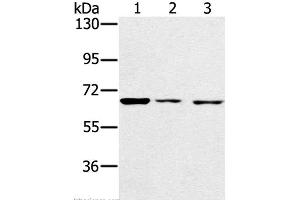 Western Blot analysis of A172, hela and hepg2 cell using IGF2BP3 Polyclonal Antibody at dilution of 1:200 (IGF2BP3 抗体)