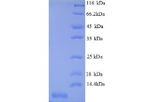 SDS-PAGE (SDS) image for Chemokine (C-X-C Motif) Ligand 3 (CXCL3) (AA 32-100) protein (His tag) (ABIN5712666)