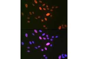 Immunofluorescence (IF) image for anti-Ligase I, DNA, ATP-Dependent (LIG1) antibody (ABIN7268251)