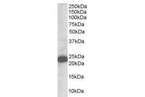 Image no. 1 for anti-Stathmin-Like 2 (STMN2) (N-Term) antibody (ABIN374200) (STMN2 抗体  (N-Term))