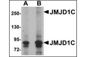 Western blot analysis of JMJD1C in human liver tissue lysate with this product at (A) 1 and (B) 2 μg/ml. (JMJD1C 抗体  (N-Term))