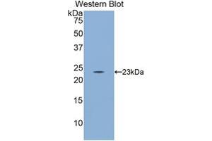Western blot analysis of the recombinant protein. (CD8B 抗体  (AA 21-208))