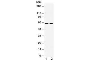 Western blot testing of 1) rat testis and 2) human MCF7 lysate with ACCN1 antibody at 0. (ACCN1 抗体  (AA 112-147))