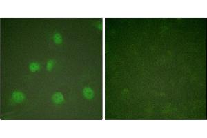 Immunofluorescence analysis of HeLa cells, treated with A (125 ng/mL, 30 mins), using Cullin 1 antibody. (Cullin 1 抗体)