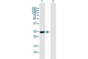 Western Blot analysis of NOG expression in transfected 293T cell line by NOG MaxPab polyclonal antibody. (NOG 抗体  (AA 1-232))