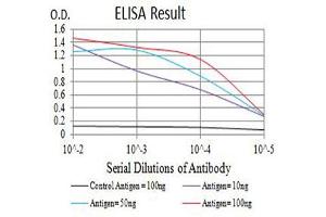 Black line: Control Antigen (100 ng),Purple line: Antigen (10 ng), Blue line: Antigen (50 ng), Red line:Antigen (100 ng) (IL2 Receptor beta 抗体  (AA 27-240))