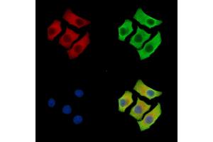 ABIN7095942 and ABIN7100004 staining Hela cells by IF/ICC.