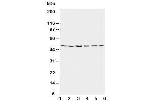 Western Blotting (WB) image for anti-Presenilin 2 (Alzheimer Disease 4) (PSEN2) (N-Term) antibody (ABIN3032302)