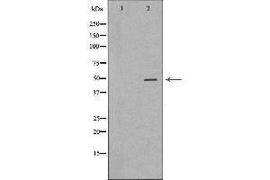 Western blot analysis of extracts from Hela  using KRT20 Antibody. (KRT20 抗体  (C-Term))