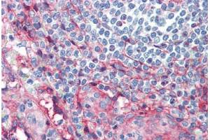 Human Spleen (formalin-fixed, paraffin-embedded) stained with ICAM1 antibody ABIN462119 followed by biotinylated anti-mouse IgG secondary antibody ABIN481714, alkaline phosphatase-streptavidin and chromogen. (ICAM1 抗体)