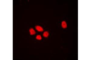 Immunofluorescent analysis of DLX3 staining in HEK293T cells. (DLX3 抗体  (Center))