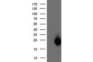 Western Blotting (WB) image for anti-ADP-Ribosylation Factor-Like 11 (ARL11) antibody (ABIN1496714) (ARL11 抗体)