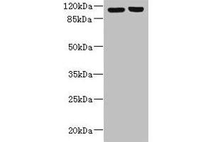 RPGR 抗体  (AA 1-180)