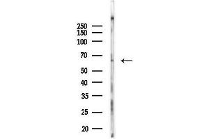 anti-Vacuolar Protein Sorting 45 (VPS45) (C-Term) antibody