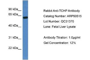 WB Suggested Anti-TCHP  Antibody Titration: 0. (TCHP 抗体  (C-Term))