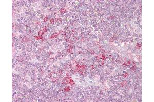 Anti-MST4 antibody IHC of human thymus. (STK26/MST4 抗体  (AA 340-354))