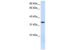 MRPL15 antibody used at 1 ug/ml to detect target protein. (MRPL15 抗体  (C-Term))