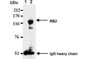 Western Blotting (WB) image for anti-Retinoblastoma-Like 2 (p130) (RBL2) antibody (ABIN487489) (p130 抗体)