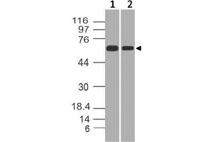 Image no. 1 for anti-Heterogeneous Nuclear Ribonucleoprotein K (HNRNPK) (AA 121-334) antibody (ABIN5027250) (HNRNPK 抗体  (AA 121-334))