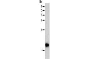 Gel: 12 % SDS-PAGE, Lysate: 40 μg, Lane: Human liver cancer tissue, Primary antibody: ABIN7128688(BTG2 Antibody) at dilution 1/200, Secondary antibody: Goat anti rabbit IgG at 1/8000 dilution, Exposure time: 10 minutes (BTG2 抗体)