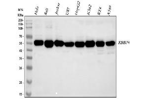 Western blot analysis of RbAp48 using anti-RbAp48 antibody (ABIN3043920).