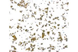Immunocytochemistry (ICC) image for anti-Tubulin, beta 3 (TUBB3) (AA 400-450) antibody (ABIN7453957) (Recombinant TUBB3 抗体  (AA 400-450))