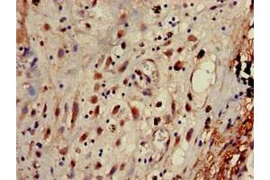 Immunohistochemistry (IHC) image for anti-Adaptor-Related Protein Complex 1, gamma 1 Subunit (AP1G1) (AA 592-686) antibody (ABIN7144346)