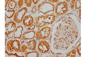 IHC image of ABIN7157690 diluted at 1:400 and staining in paraffin-embedded human kidney tissue performed on a Leica BondTM system. (KANK2 抗体  (AA 410-585))