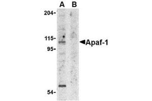 Image no. 2 for anti-Apoptotic Peptidase Activating Factor 1 (APAF1) (AA 12-28) antibody (ABIN319002)