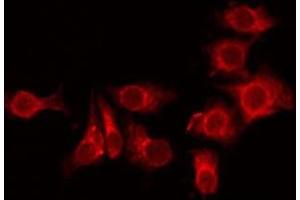 TMEM101 anticorps  (Internal Region)