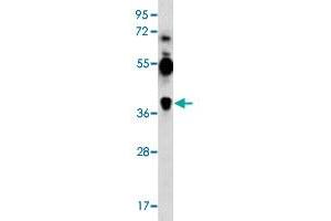 Western blot analysis of K-562 cell lysate (35 ug/lane) with MAGEA12 polyclonal antibody . (MAGEA12 抗体  (N-Term))