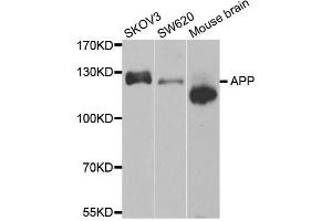 Western blot analysis of extracts of various cell lines, using APP antibody. (APP 抗体)