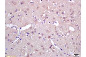 Formalin-fixed and paraffin embedded rat brain labeled with Rabbit Anti SPAG5/MAP126/Astrin Polyclonal Antibody, Unconjugated (ABIN672261) at 1:200 followed by conjugation to the secondary antibody and DAB staining (SPAG5 抗体  (AA 1101-1193))