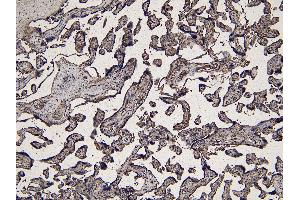 Immunohistochemistry (IHC) image for anti-Indoleamine 2,3-Dioxygenase 1 (IDO1) (Internal Region) antibody (ABIN185488)