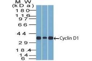 Western Blot Analysis of Cyclin D1 (1) C2C12, (2) HepG2, & (3) NIH3T3 cell lysate Cyclin D1 Mouse Monoclonal Antibody (DCS-6).