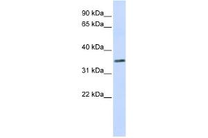 WB Suggested Anti-C2orf60 Antibody Titration:  0. (C2orf60 抗体  (Middle Region))