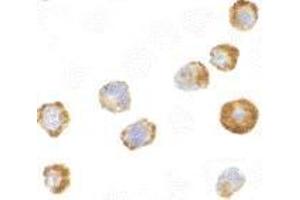 Immunocytochemistry of ASK1 in A431 cells with AP30086PU-N ASK1 antibody at 2 μg/ml. (ASK1 抗体)