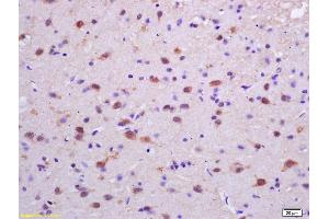 Formalin-fixed and paraffin embedded rat brain labeled with Rabbit Anti phospho-PKC delta (Tyr311) Polyclonal Antibody, Unconjugated (ABIN703270) at 1:200 followed by conjugation to the secondary antibody and DAB staining (PKC delta 抗体  (pTyr313))