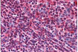 Human Tonsil (formalin-fixed, paraffin-embedded) stained with CD5L antibody ABIN214596 at 5 ug/ml followed by biotinylated goat anti-rabbit IgG secondary antibody ABIN481713, alkaline phosphatase-streptavidin and chromogen. (CD5L 抗体  (N-Term))