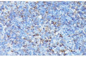Immunohistochemistry of paraffin-embedded Mouse spleen using CXCR1 Polyclonal Antibody at dilution of 1:100 (40x lens). (CXCR1 抗体)