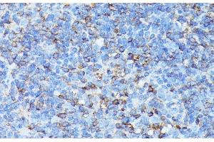 Immunohistochemistry of paraffin-embedded Mouse spleen using CXCR1 Polyclonal Antibody at dilution of 1:100 (40x lens). (CXCR1 抗体)