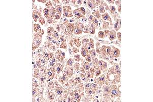 Paraformaldehyde-fixed, paraffin embedded human liver tissue, Antigen retrieval by boiling in sodium citrate buffer (pH6. (ALDH6A1 抗体)