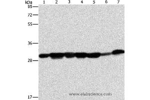 Western blot analysis of Human placenta tissue and A549 cell, mouse brain tissue and hepG2 cell, Raji cell and human fetal liver tissue, hela cell, using AK2 Polyclonal Antibody at dilution of 1:300 (Adenylate Kinase 2 抗体)