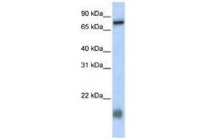 Image no. 1 for anti-Leber Congenital Amaurosis 5-Like (LCA5L) (N-Term) antibody (ABIN6740944) (LCA5L 抗体  (N-Term))