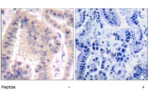 Image no. 1 for anti-Eukaryotic Translation Initiation Factor 4B (EIF4B) (AA 420-424) antibody (ABIN401568) (EIF4B 抗体  (AA 420-424))