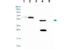 Western blot analysis of Lane 1: RT-4 Lane 2: U-251 MG Lane 3: Human Plasma Lane 4: Liver Lane 5: Tonsil with PPAN-P2RY11 polyclonal antibody . (PPAN 抗体)