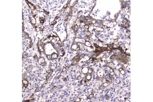 IHC analysis of MAP1LC3A using anti-MAP1LC3A antibody . (MAP1LC3A 抗体  (AA 1-120))