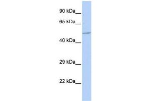 WB Suggested Anti-B4GALT3 Antibody Titration:  0. (B4GALT3 抗体  (Middle Region))