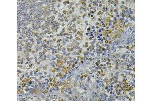 Immunohistochemistry of paraffin-embedded Rat spleen using CEBPE Polyclonal Antibody at dilution of 1:100 (40x lens). (CEBPE 抗体)